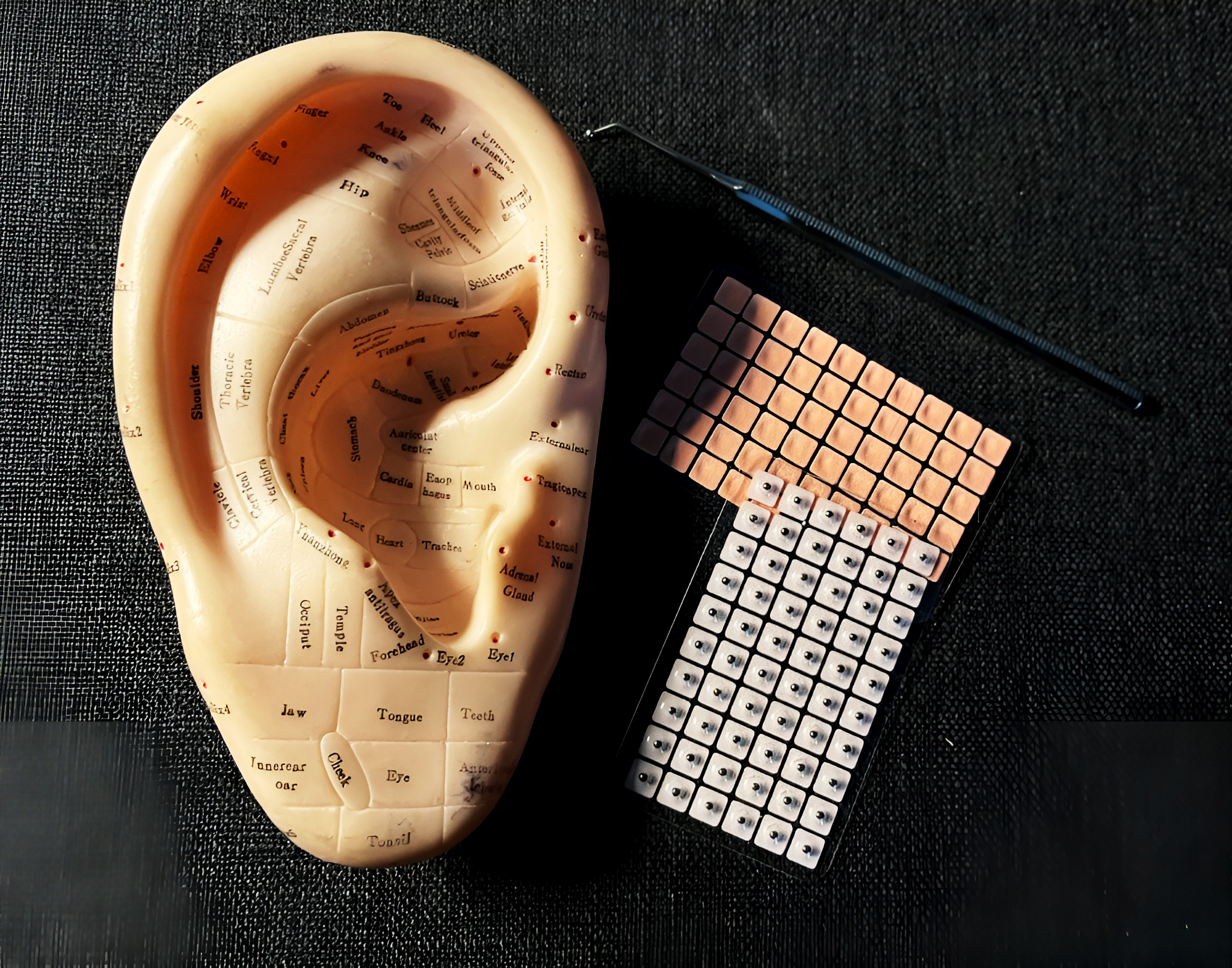 Auricular (Ear) Acupuncture